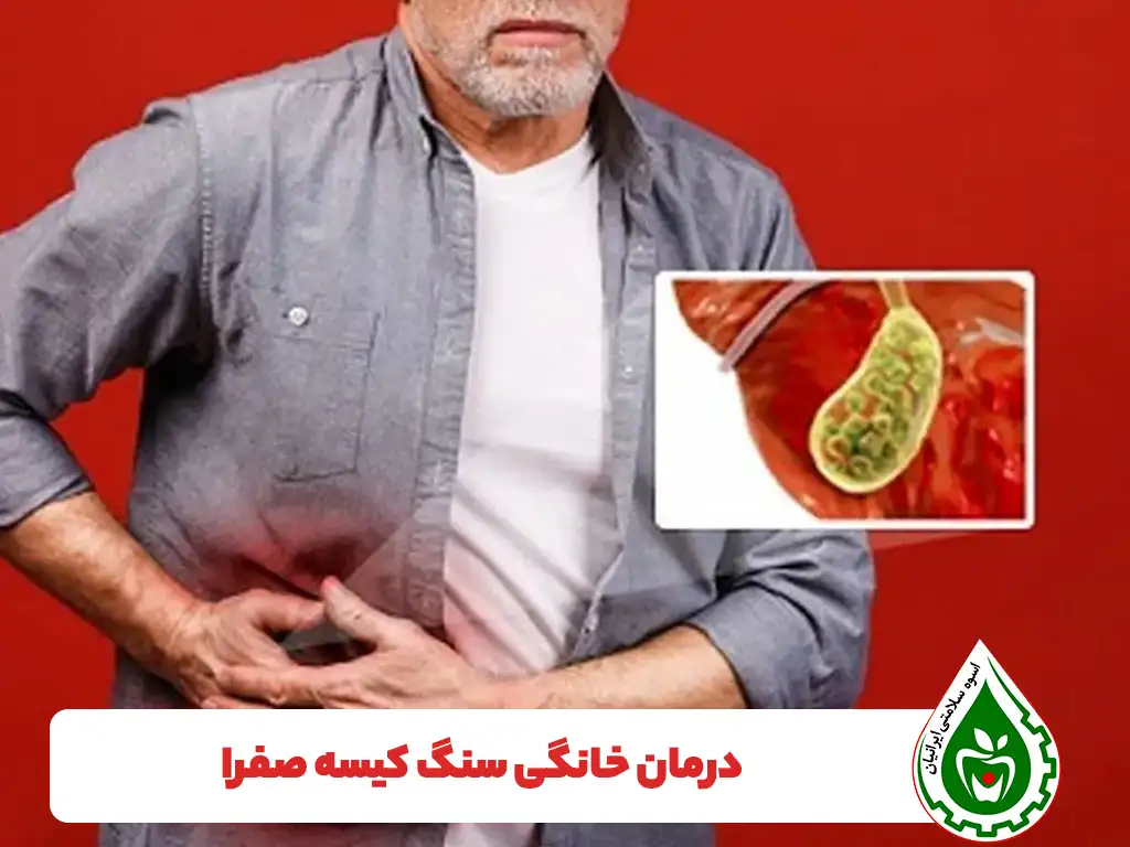 درمان سنگ کیسه صفرا