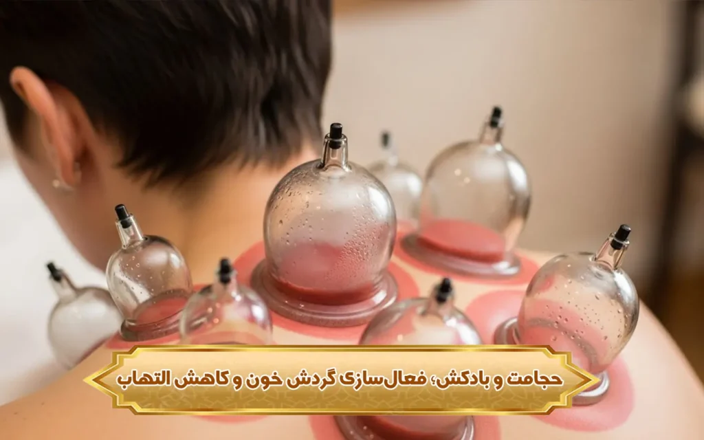 تصویر حجامت و بادکش؛ فعال‌سازی گردش خون و کاهش التهاب